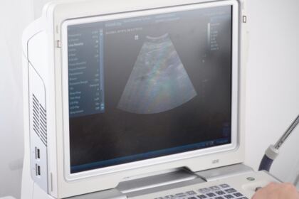 Vizită misionară şi caravană medicală în satul Ciureştii Noi, judeţul Galaţi – fotografia 32