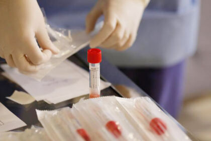 Arhiepiscopia Dunării de Jos se implică în achiziţia unui aparat performant pentru diagnosticarea Covid-19 – fotografia 3