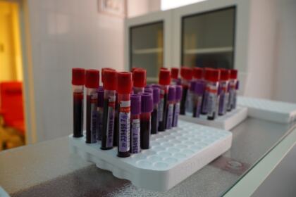 În Arhiepiscopia Dunării de Jos continuă campania de donare de sânge şi plasmă convalescentă Covid-19 – fotografia 19