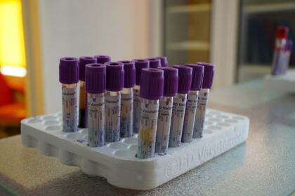 O nouă acţiune de donare de sânge a preoţilor şi credincioşilor din Protopopiatul Tecuci – fotografia 18